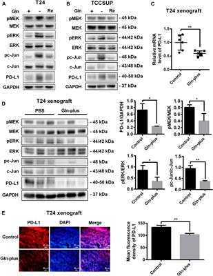 Immunosuppression Induced by Glutamine Deprivation Occurs via Activating PD-L1 Transcription in Bladder Cancer